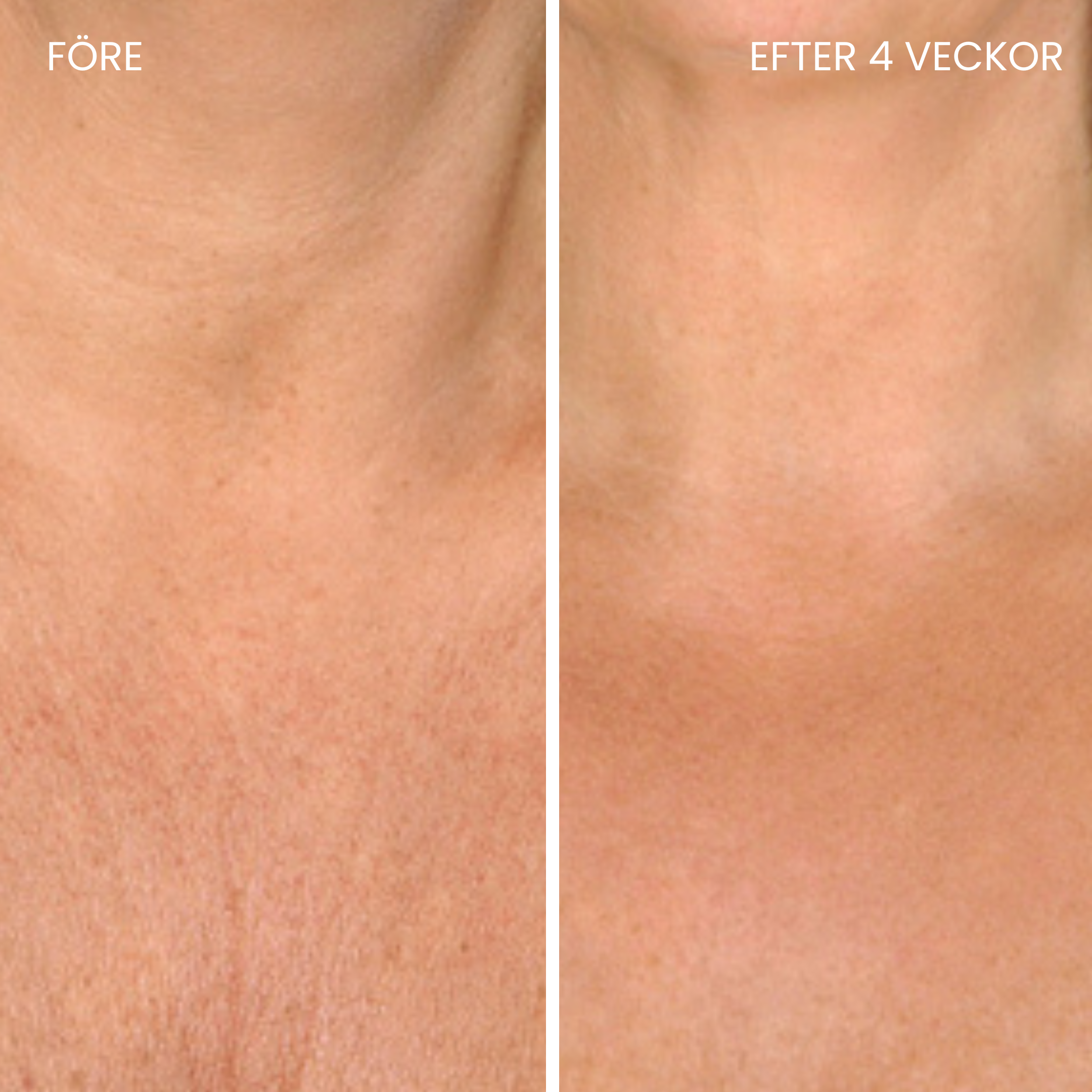 Skinboosting LED collar