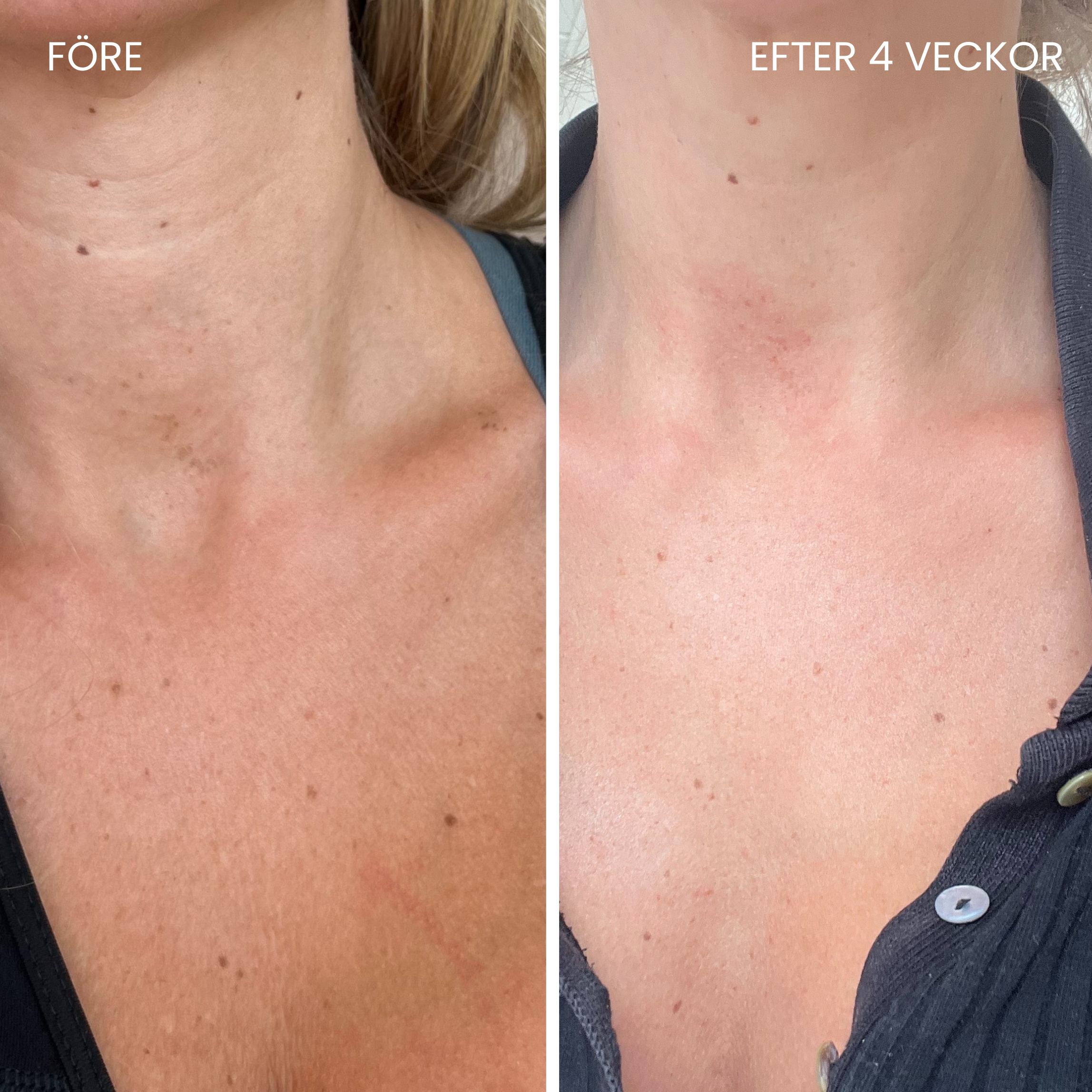 Skinboosting LED collar