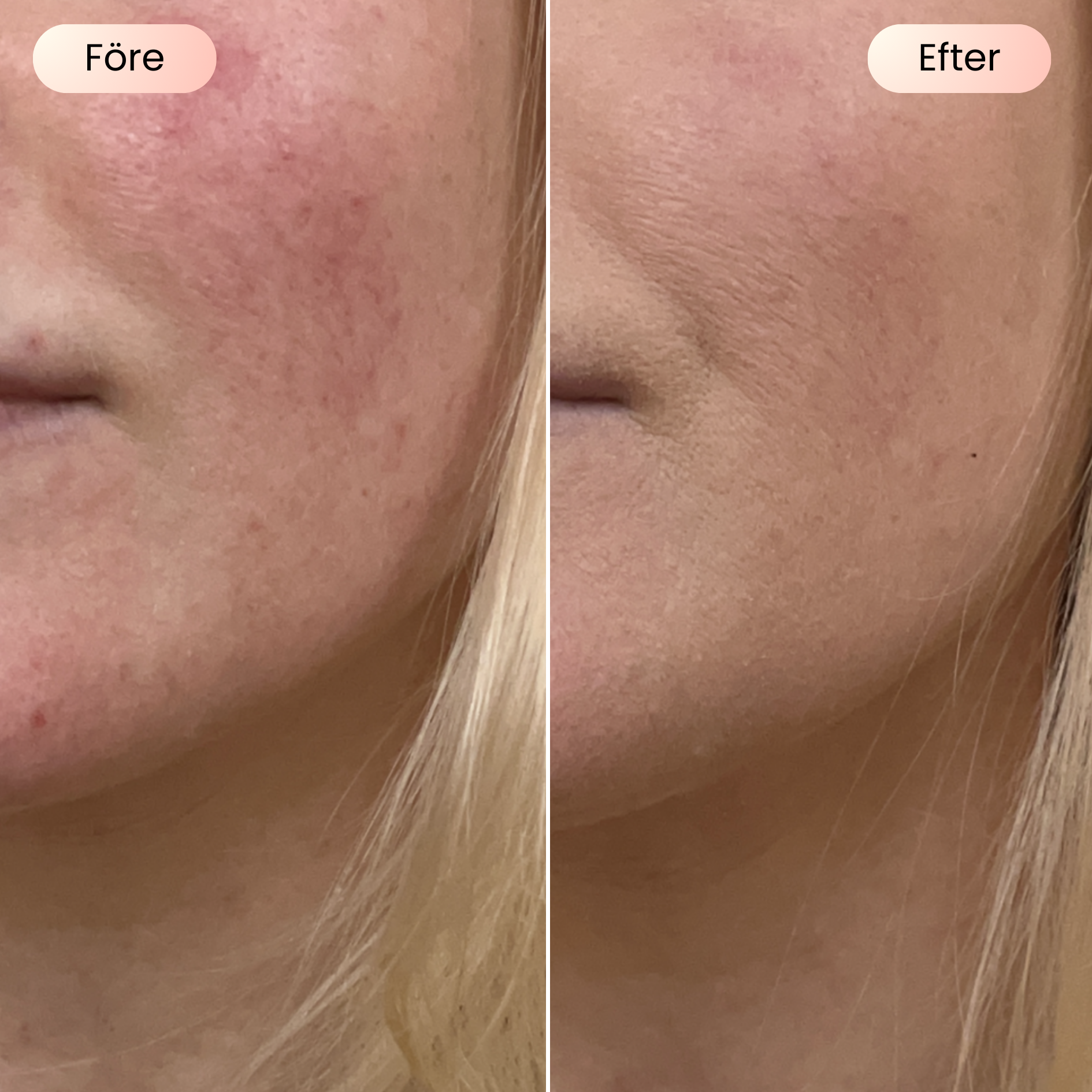 SCANDIFACE Skinboosting LED mask