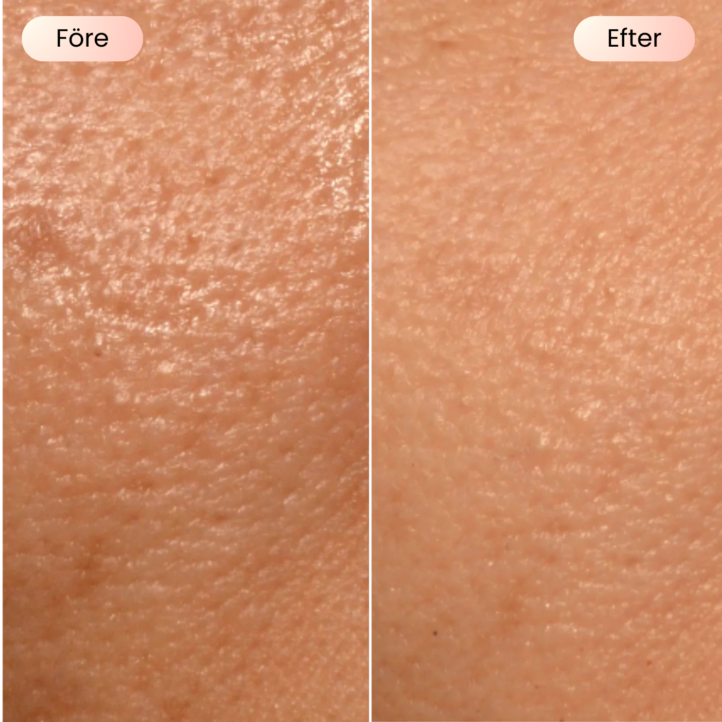 SCANDIFACE Skinboosting LED mask