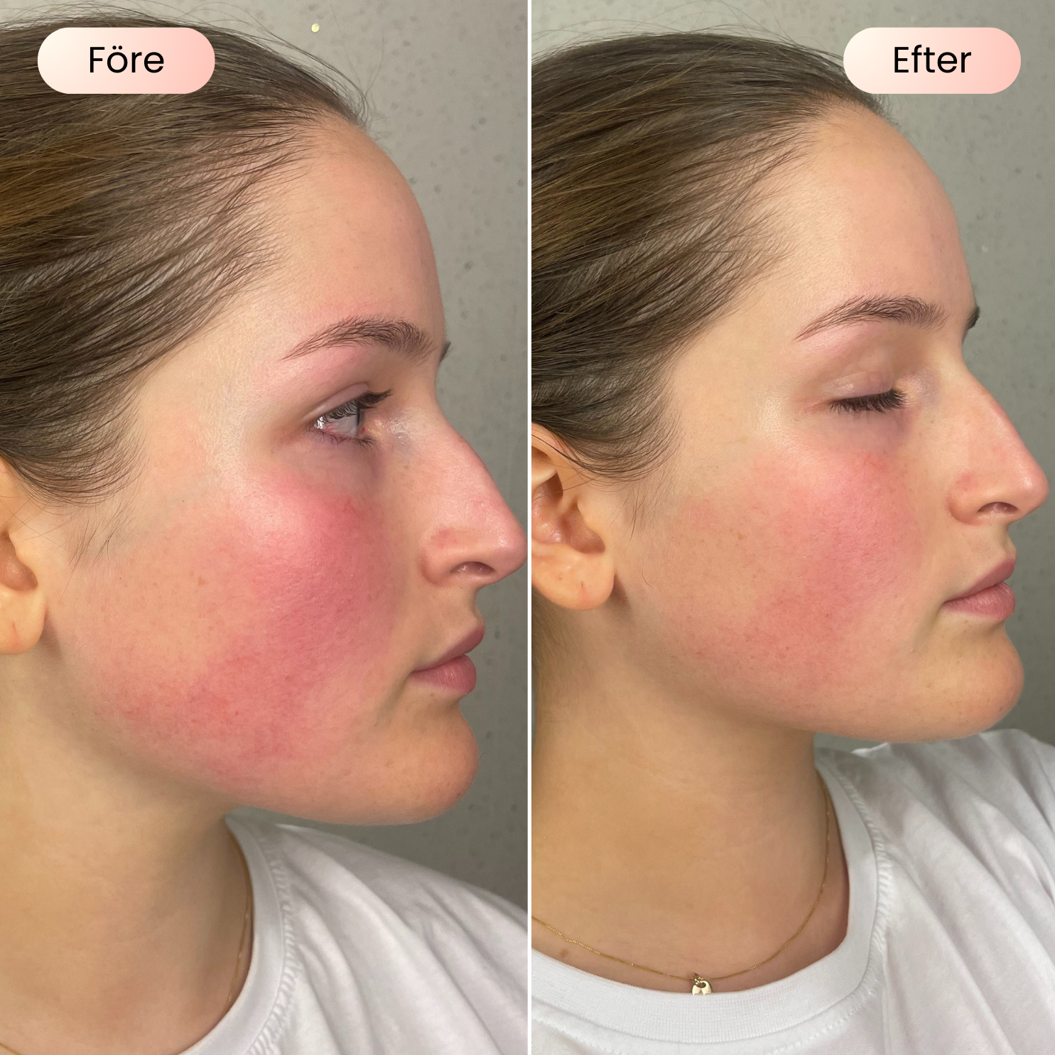 SCANDIFACE Skinboosting LED mask