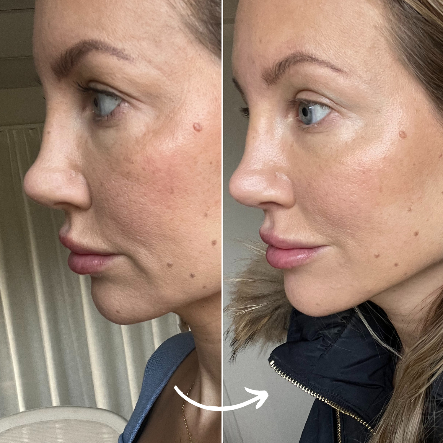 SCANDIFACE Skinboosting LED mask