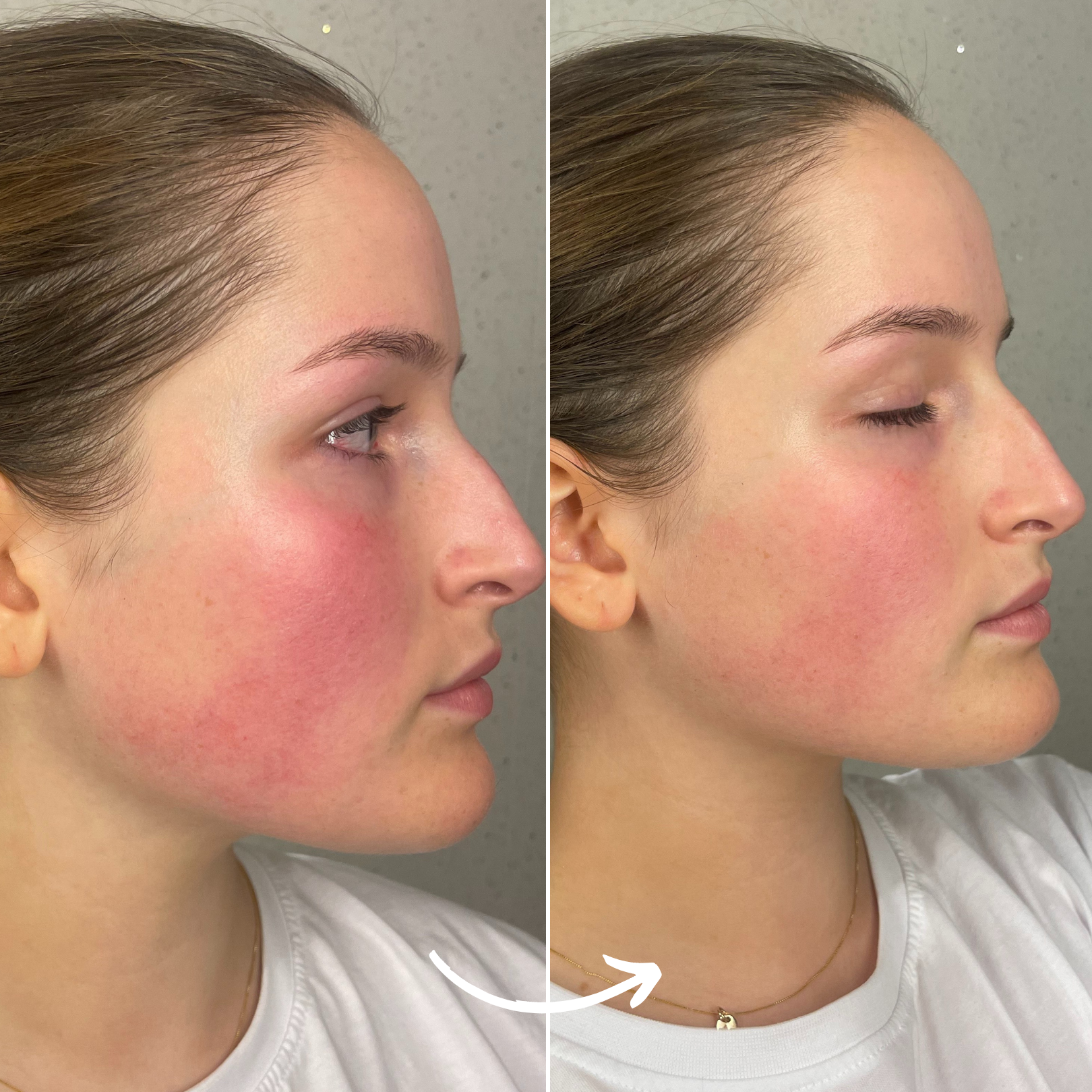 SCANDIFACE Skinboosting LED mask