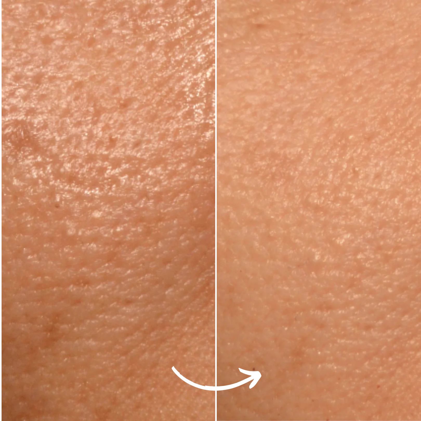 SCANDIFACE Skinboosting LED mask