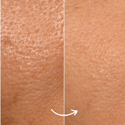 SCANDIFACE Skinboosting LED mask