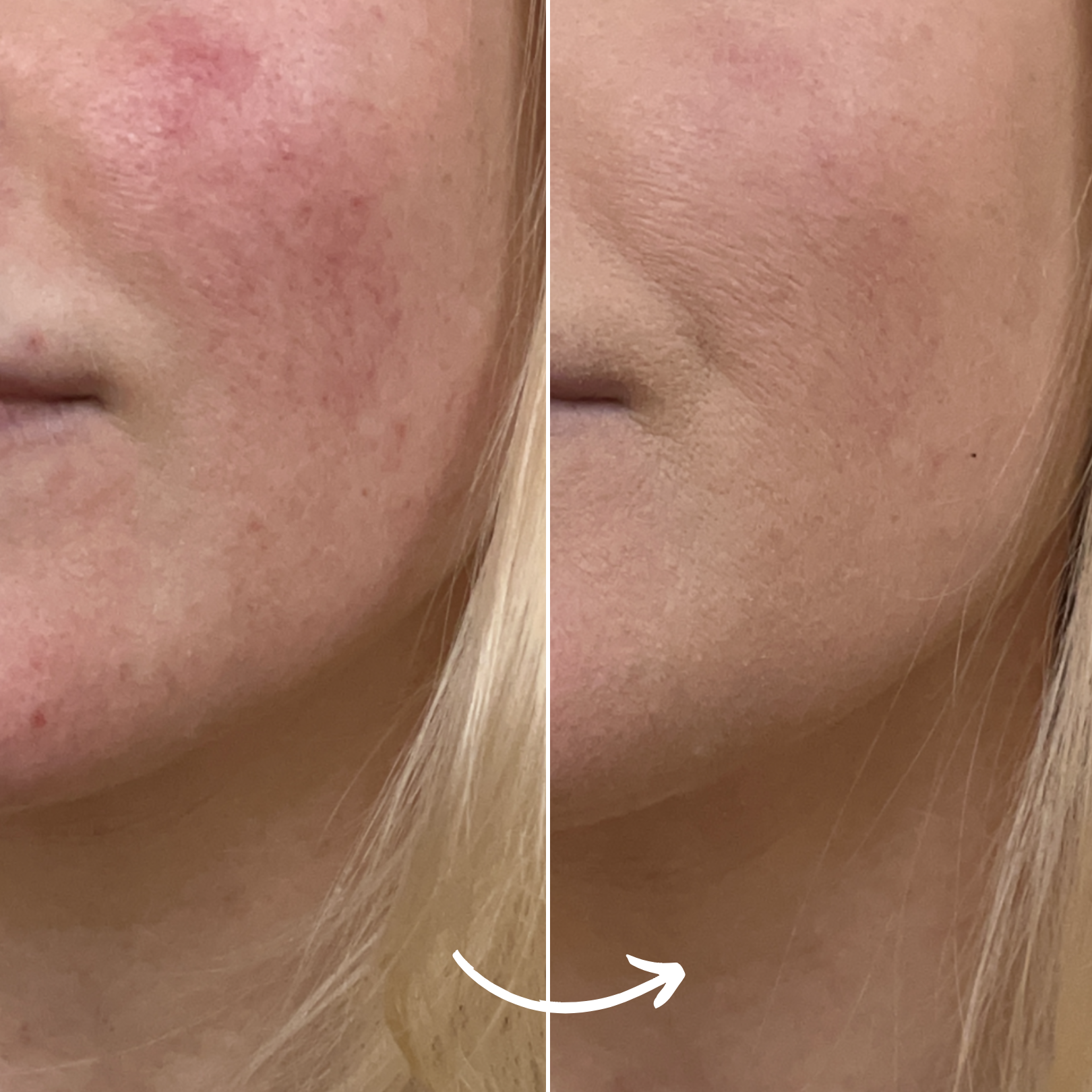SCANDIFACE Skinboosting LED mask