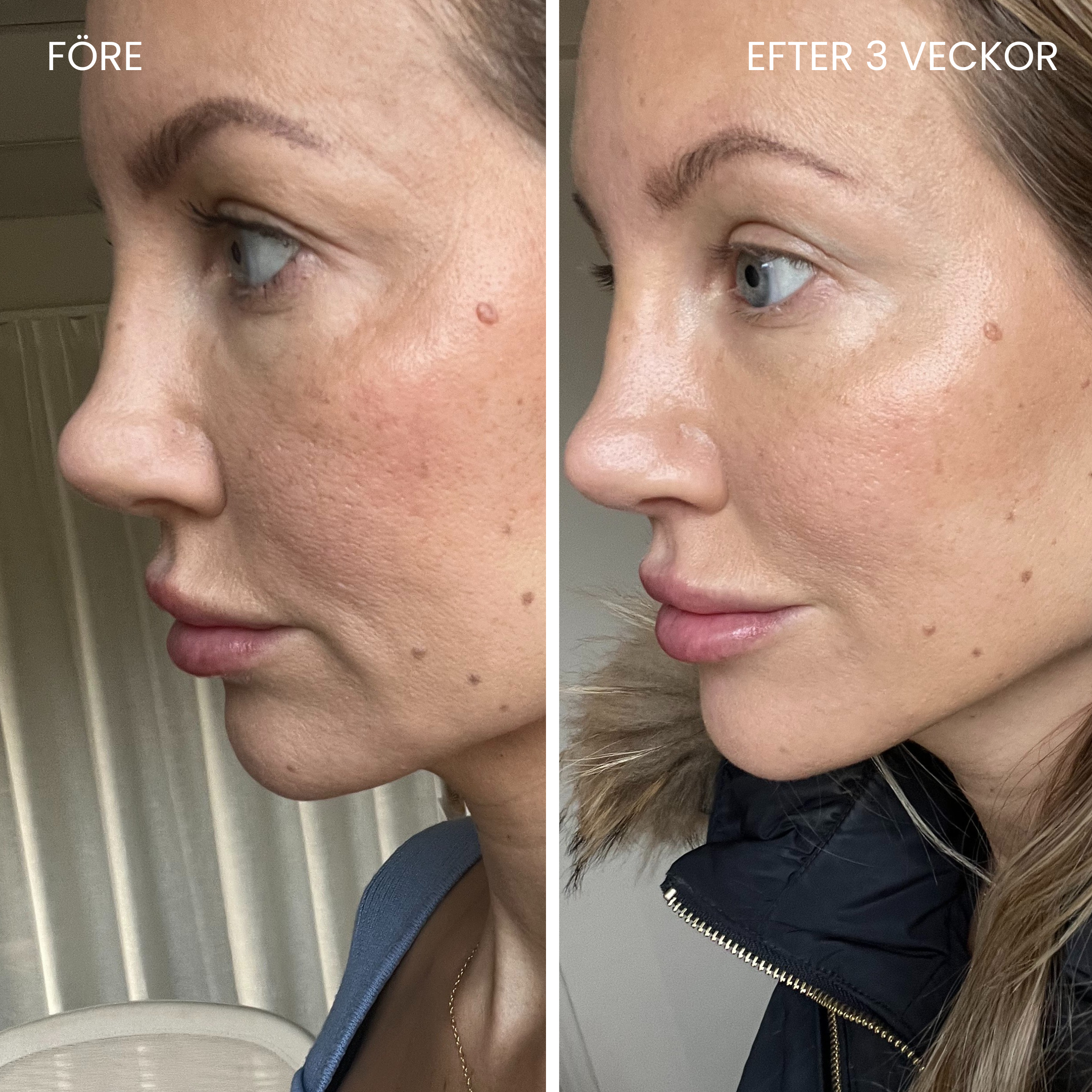Skin-boosting LED mask