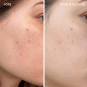 Skin-boosting LED mask