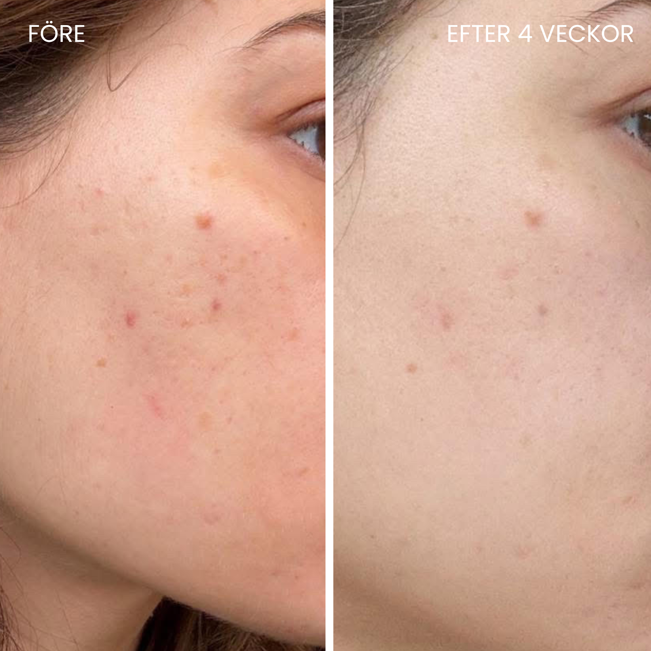 Skin-boosting LED mask