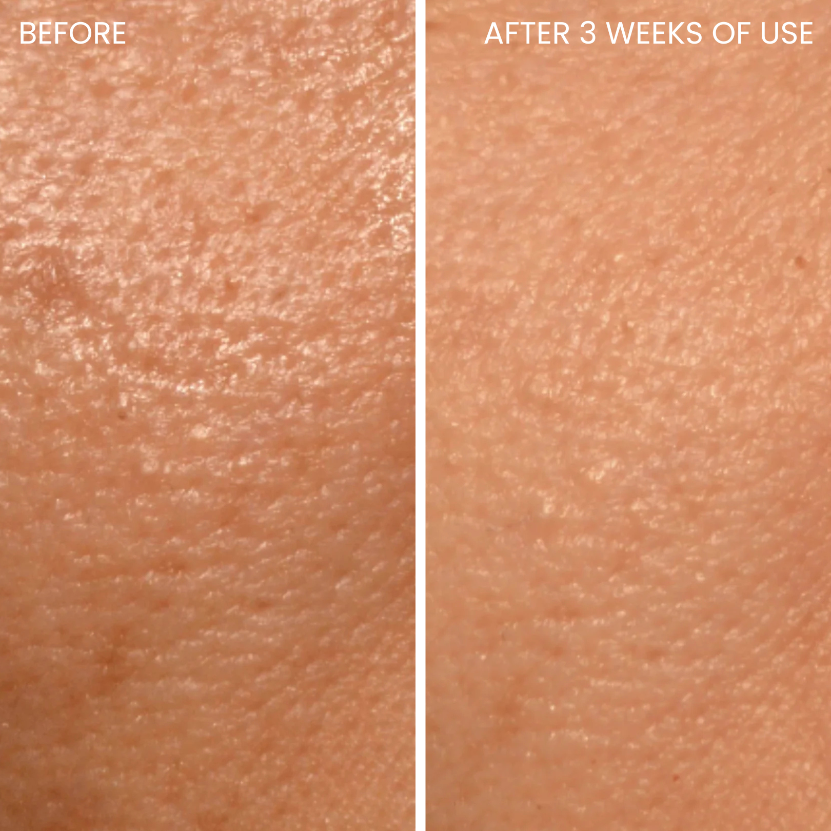 Skinboosting LED mask