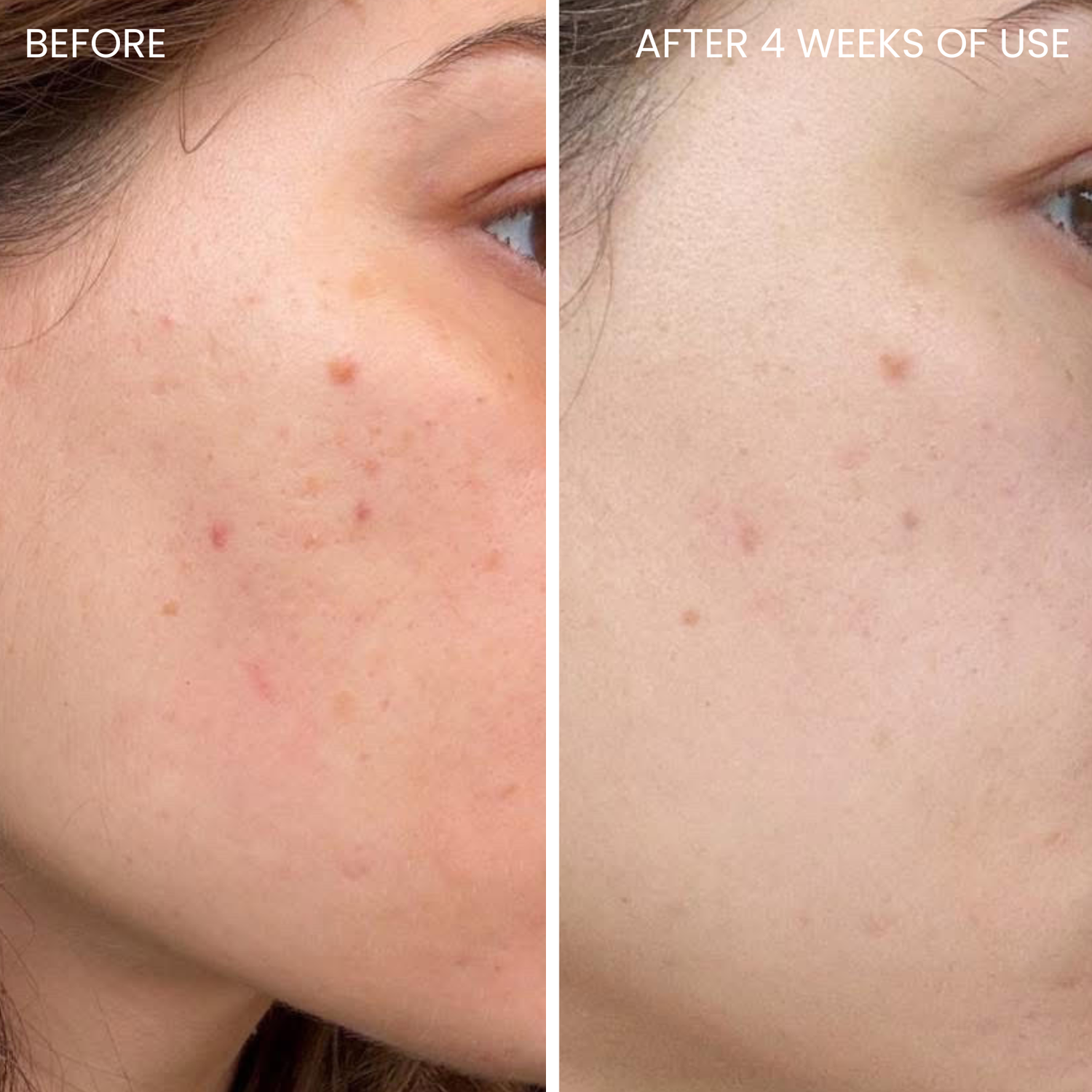 Skinboosting LED mask