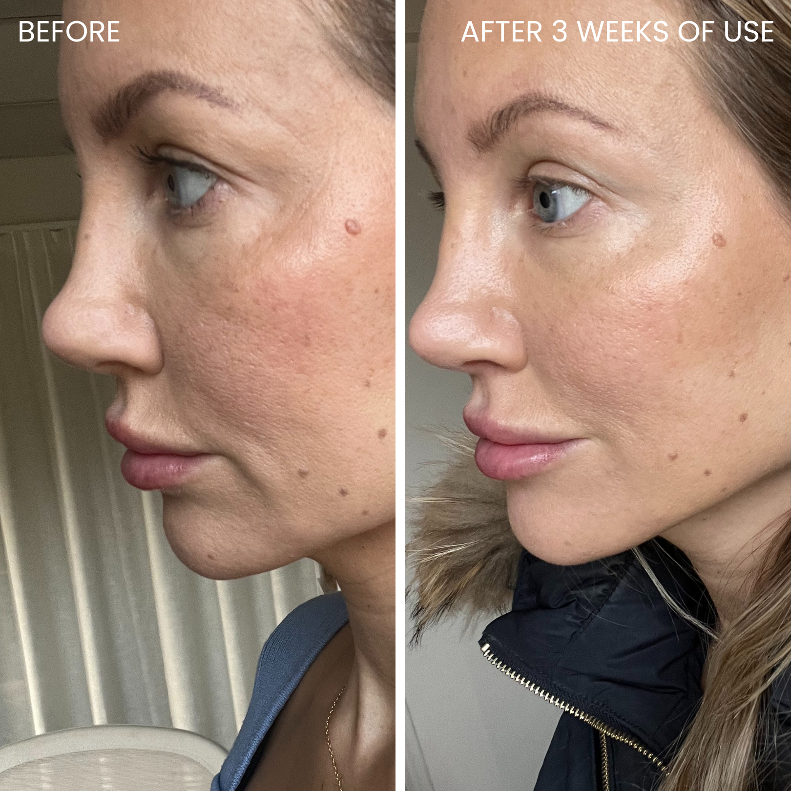 Skinboosting LED mask